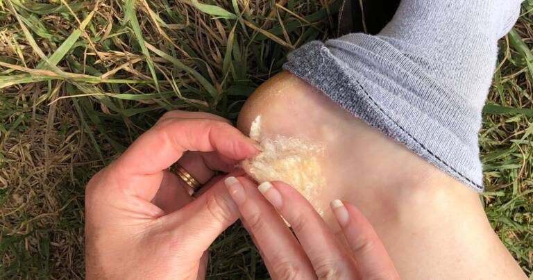 Prevent blisters while hiking with lambswool