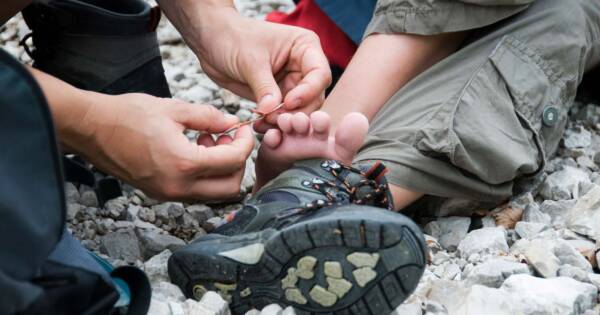 Blister prevention