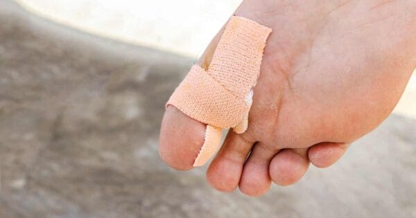 Protecting your toes during hikes